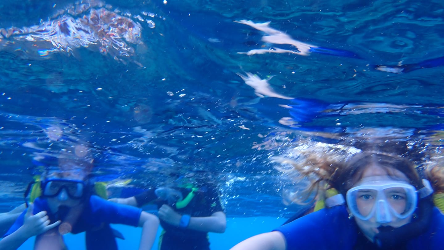 Customer photo review of Sharkbanz 2 – Wearable Shark Deterrent