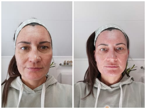 Customer photo review of Kollagen Boosting Maske