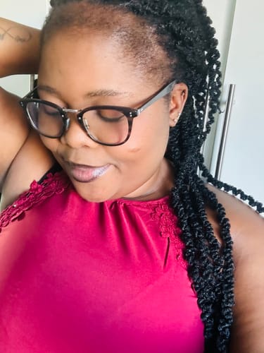 Customer photo review of Minoxi5 Minoxidil SOLUTION, 3 PACK