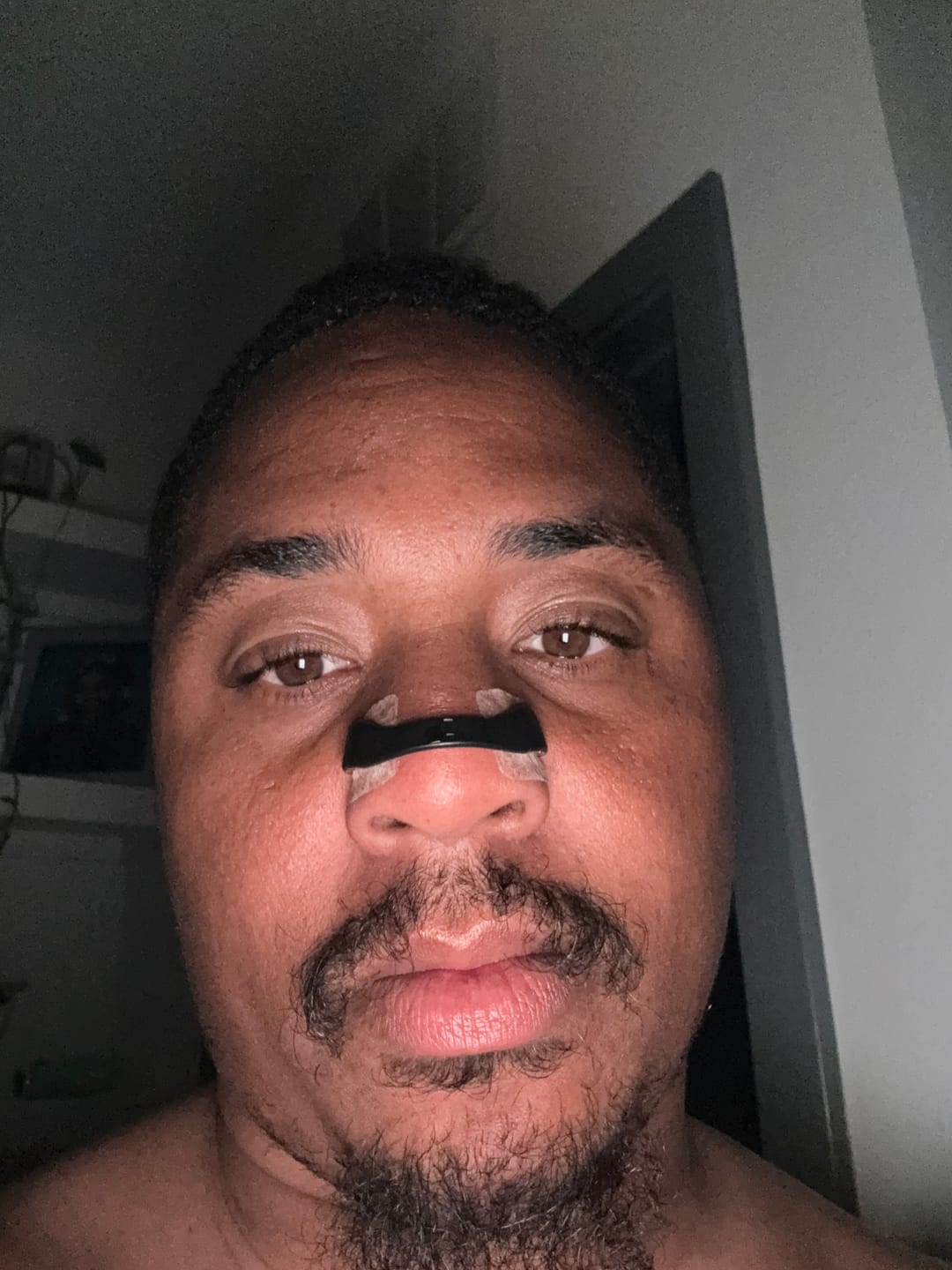 Customer photo review of Intake Mouth Tape (30 Pack)