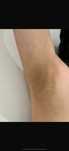 Customer photo review of Bright Skin Bish