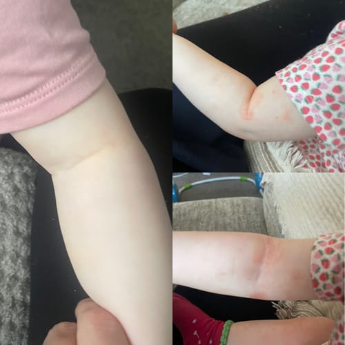 Customer photo review of Calm Balm