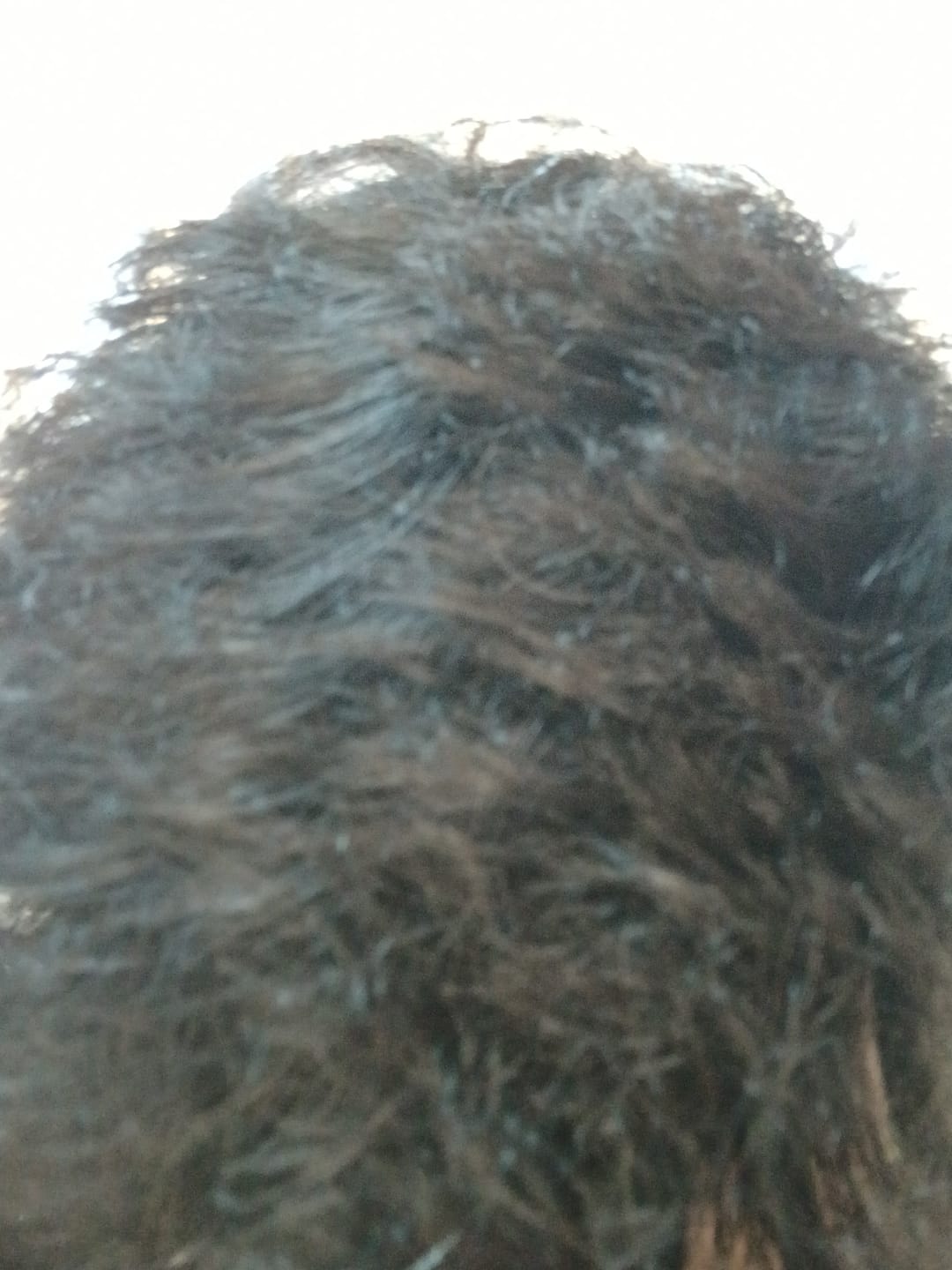 Customer photo review of Pack Anticaída de Cabello para 1 Mes