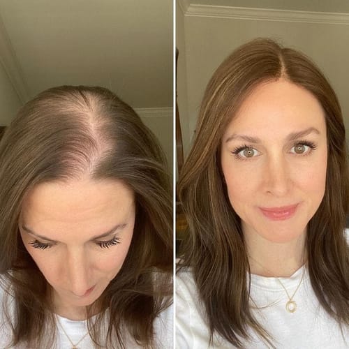 Naomi Y. review of LOVILDS™ Root Revival Roll-On image 1 out of 1