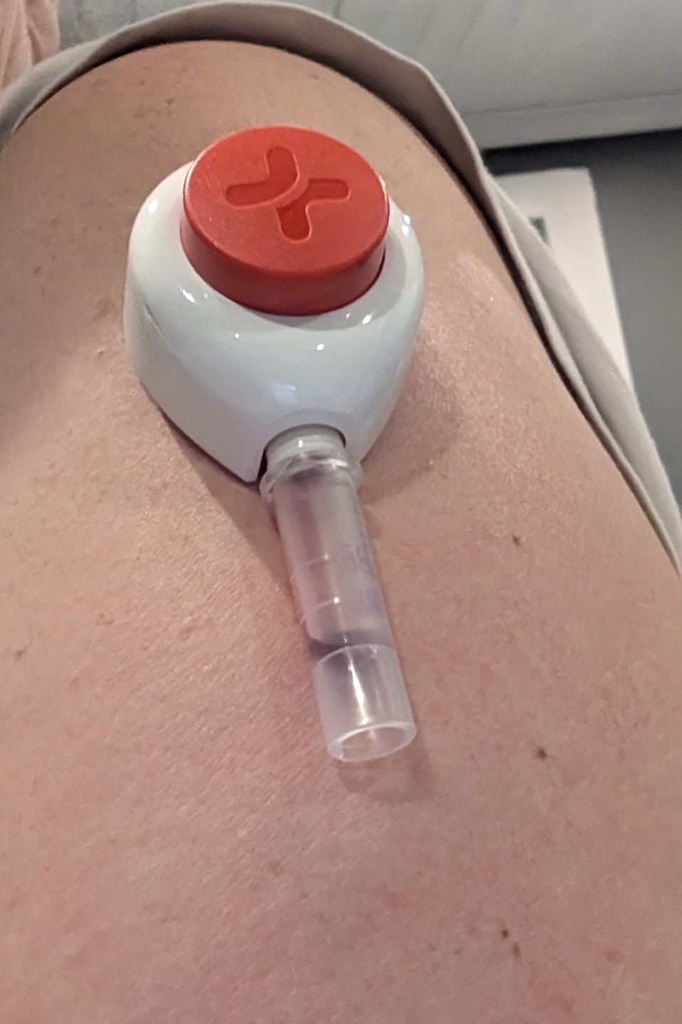 Customer photo review of EarlyReveal Tap DNA Gender Test Over 99% Accurate | Painless & Needle Free | Next Day Results