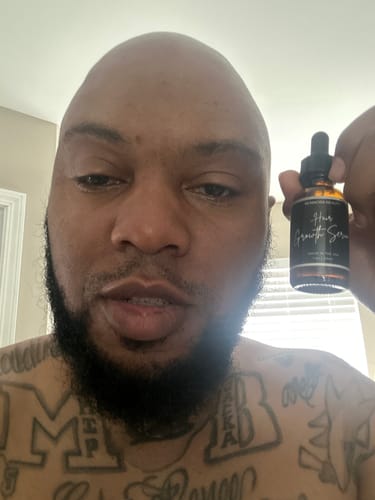 Customer photo review of Rennora Hair Growth Serum