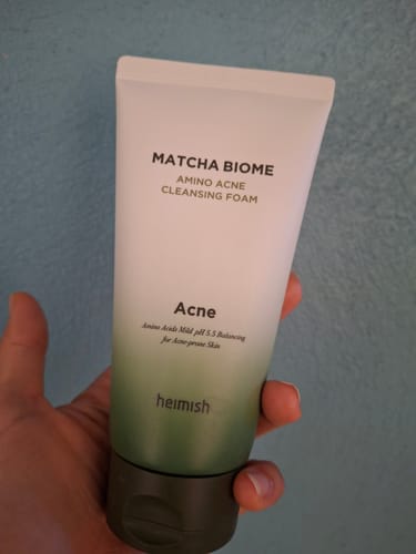 Customer photo review of Matcha Biome Amino Acne Cleansing Foam