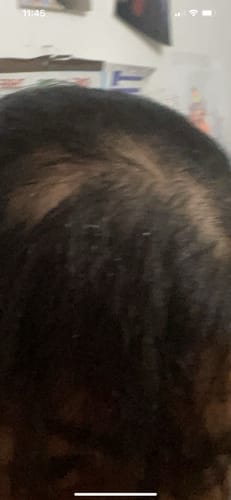 Customer photo review of VITAFOAM ™ Hair Growth Formula