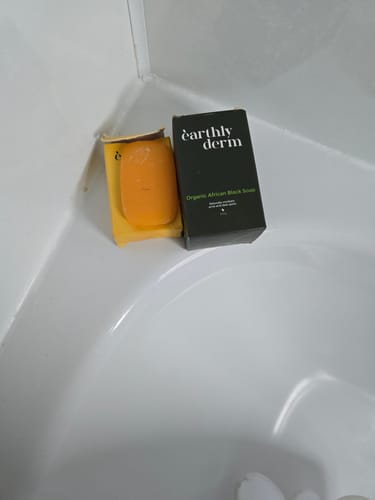 Customer photo review of Anti-Acne & Dark Spots African Soap