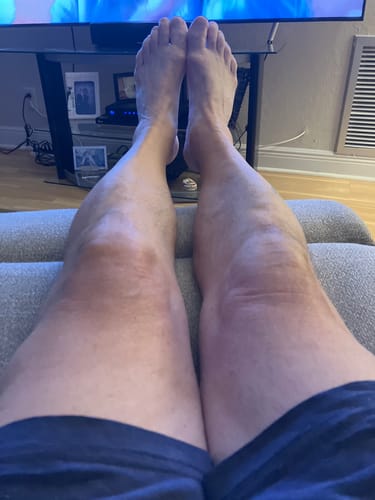 Customer photo review of Bro Glo Foam Body Tanner - Darker