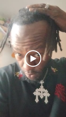 Customer video review of Rennora Hair Growth Serum