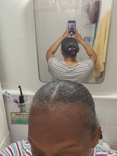Customer photo review of Hair Growth Bundle