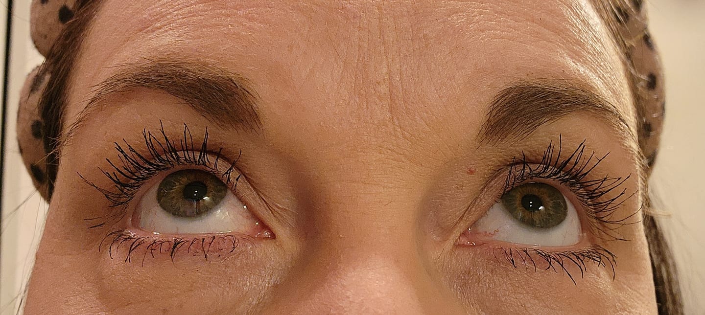 Customer photo review of EYELASH GROWTH SOLUTION