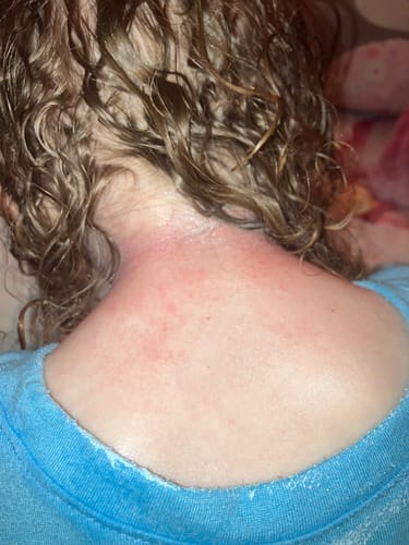 Customer photo review of F-Balm (Anti-aging Tallow Balm) 2 oz. Tin