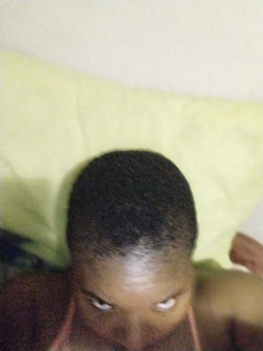 Customer photo review of Minoxi5 Minoxidil SOLUTION, 3 PACK