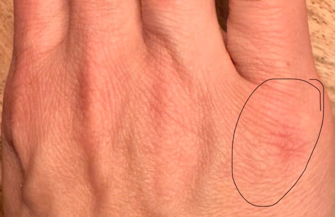 Customer photo review of Repair Balm No.3