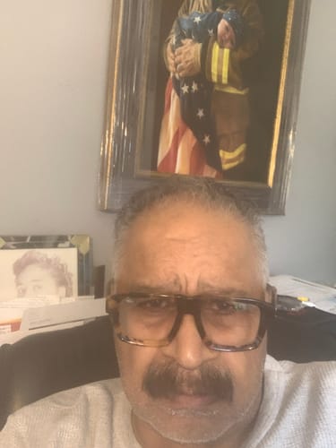 Customer photo review of Rennora Hair Growth Serum