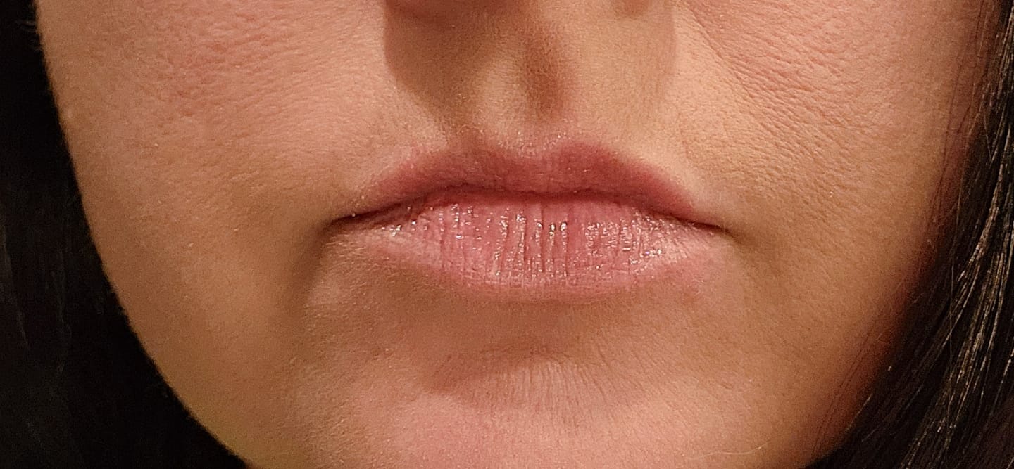 Customer photo review of Coconut Lip Mask