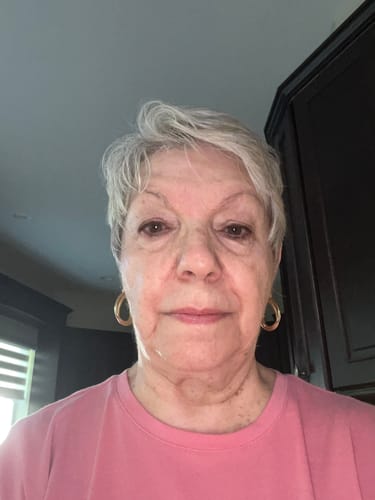 Customer photo review of F-Balm (Anti-aging Tallow Balm) 2 oz. Tin