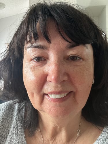 Customer photo review of F-Balm Whipped Body Butter 100ml (3.3oz)