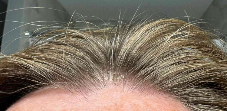 Customer photo review of Omega Rich Shampoo Twin Pack