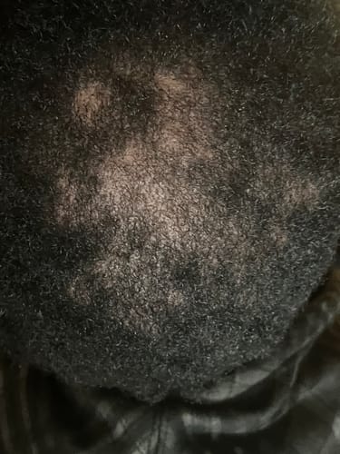 Customer photo review of VIRAL "EXTREME STRENGTH" Hair Growth Serum -