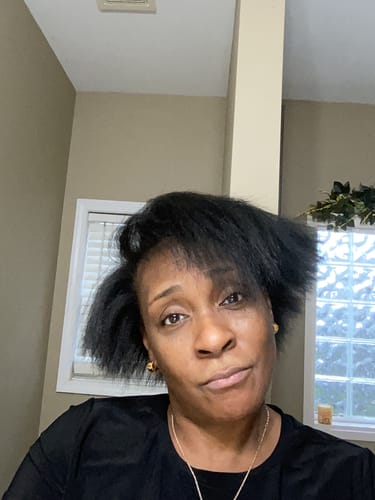 Customer photo review of Rennora EXTRA-Strength Hair Growth Serum