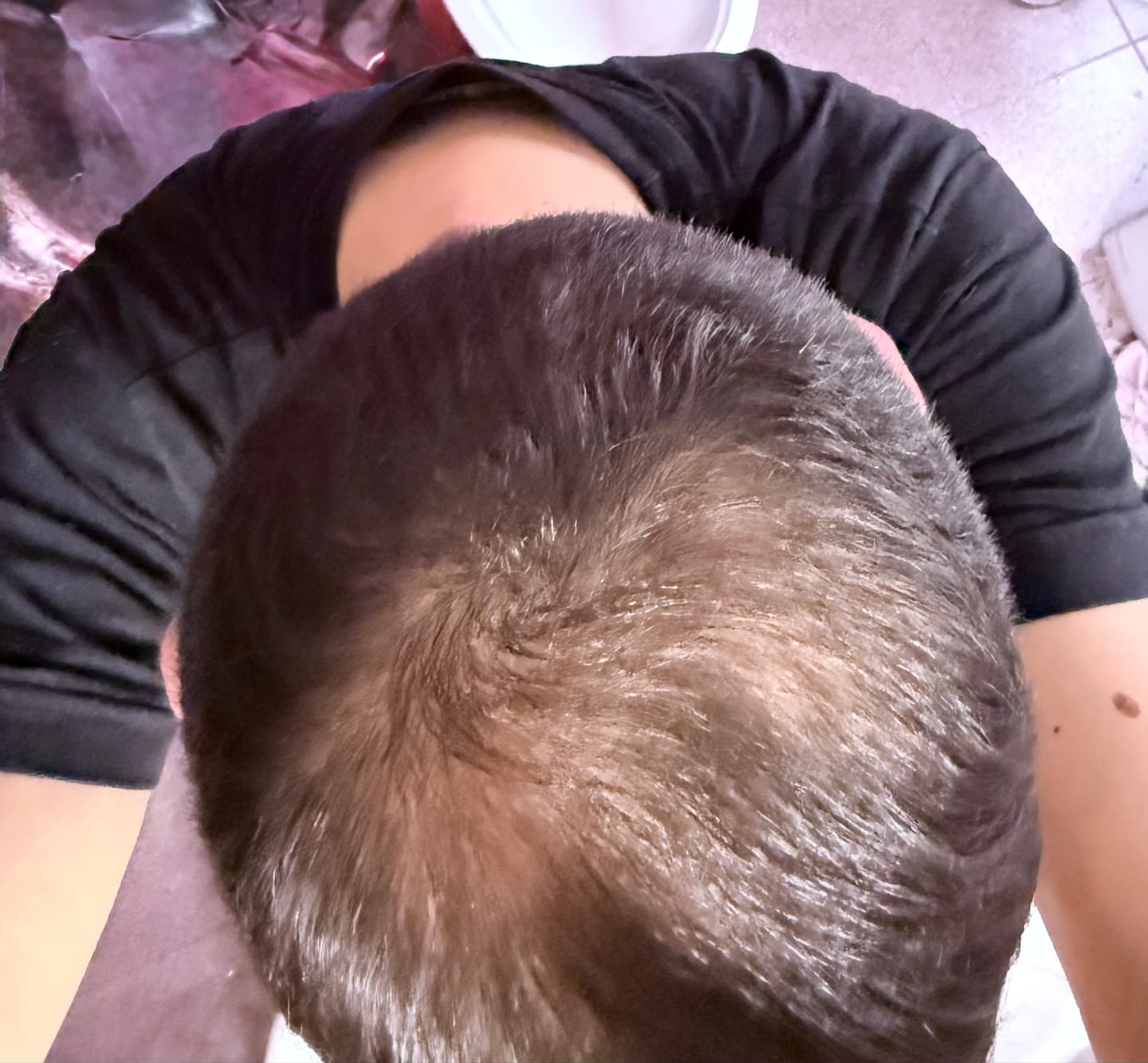 Customer photo review of Fibre copri Calvizie da 27.5gr  | Castano Scuro | 60 Giorni di applicazioni