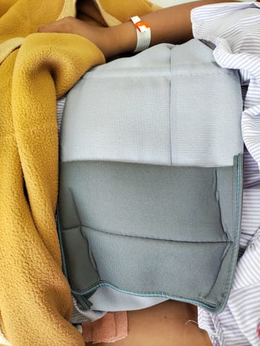 Customer photo review of Abdominal Belt (8") |Supports the Weak Abdominal Muscles to Relieve Pain (Beige)