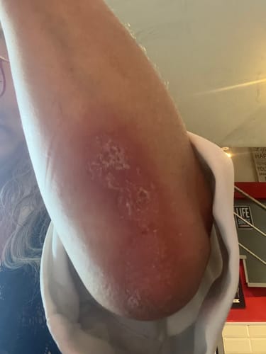 Customer photo review of Sereni Pikkelysömör és Ekcéma Krém