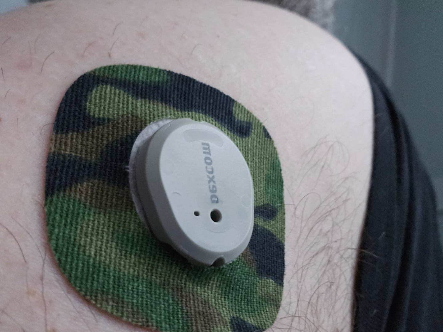 Customer photo review of Skin Grip Original - Dexcom G7 & Stelo Adhesive Patches (With Cutout)