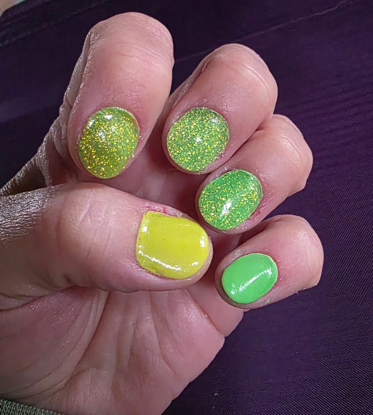 Customer photo review of Neon Yellow Dipping Powder