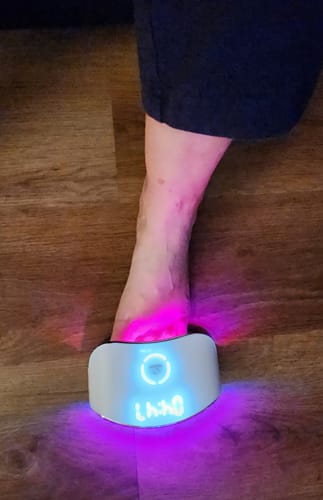 Customer photo review of Pentachom SE Antifungal Laser Program