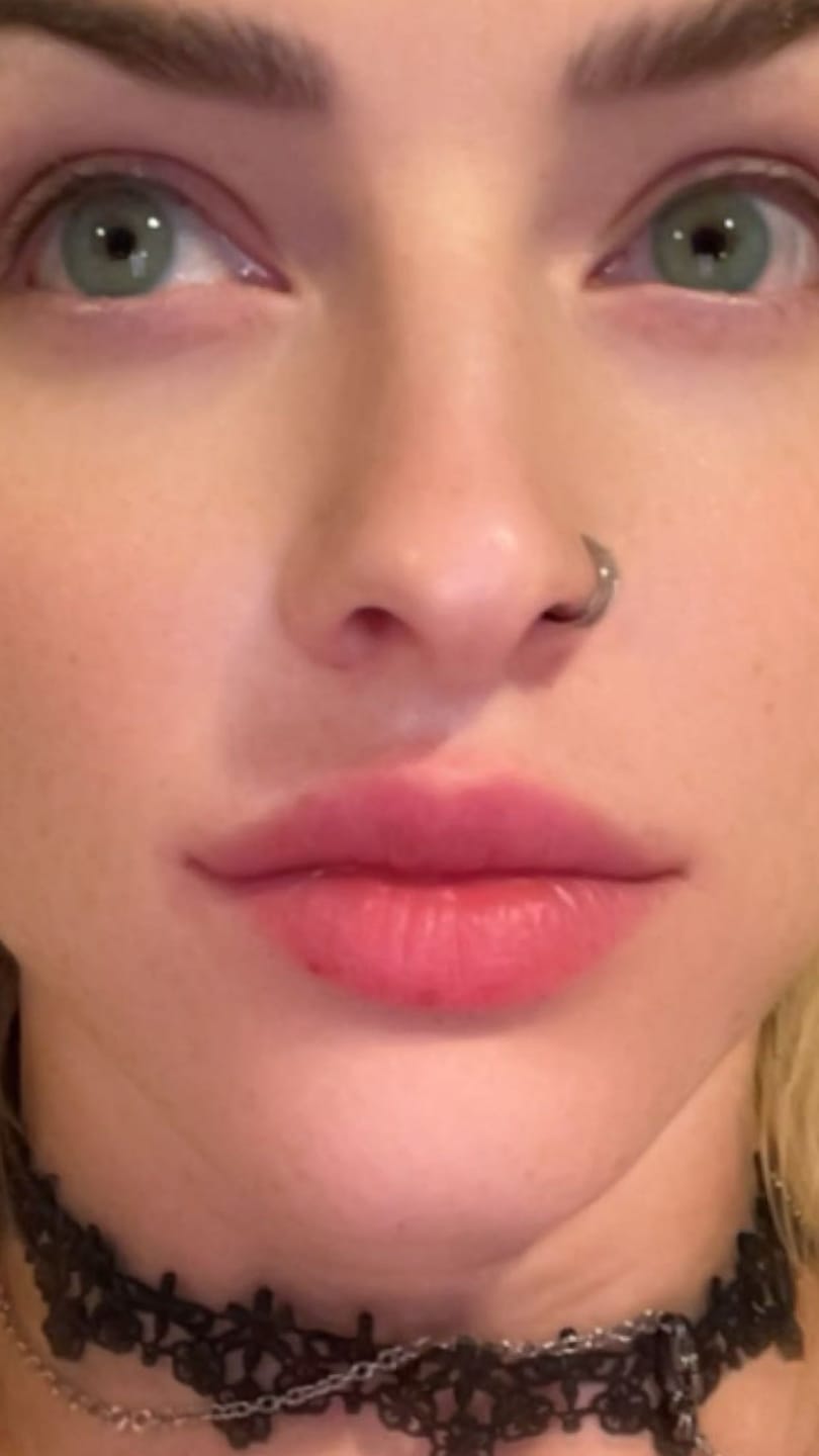 Customer photo review of Cherry OCEAN Blue Prescription Colored Contact Lenses