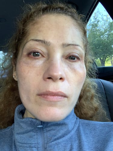 Customer photo review of INIA FLARE Microcurrent Facial Device