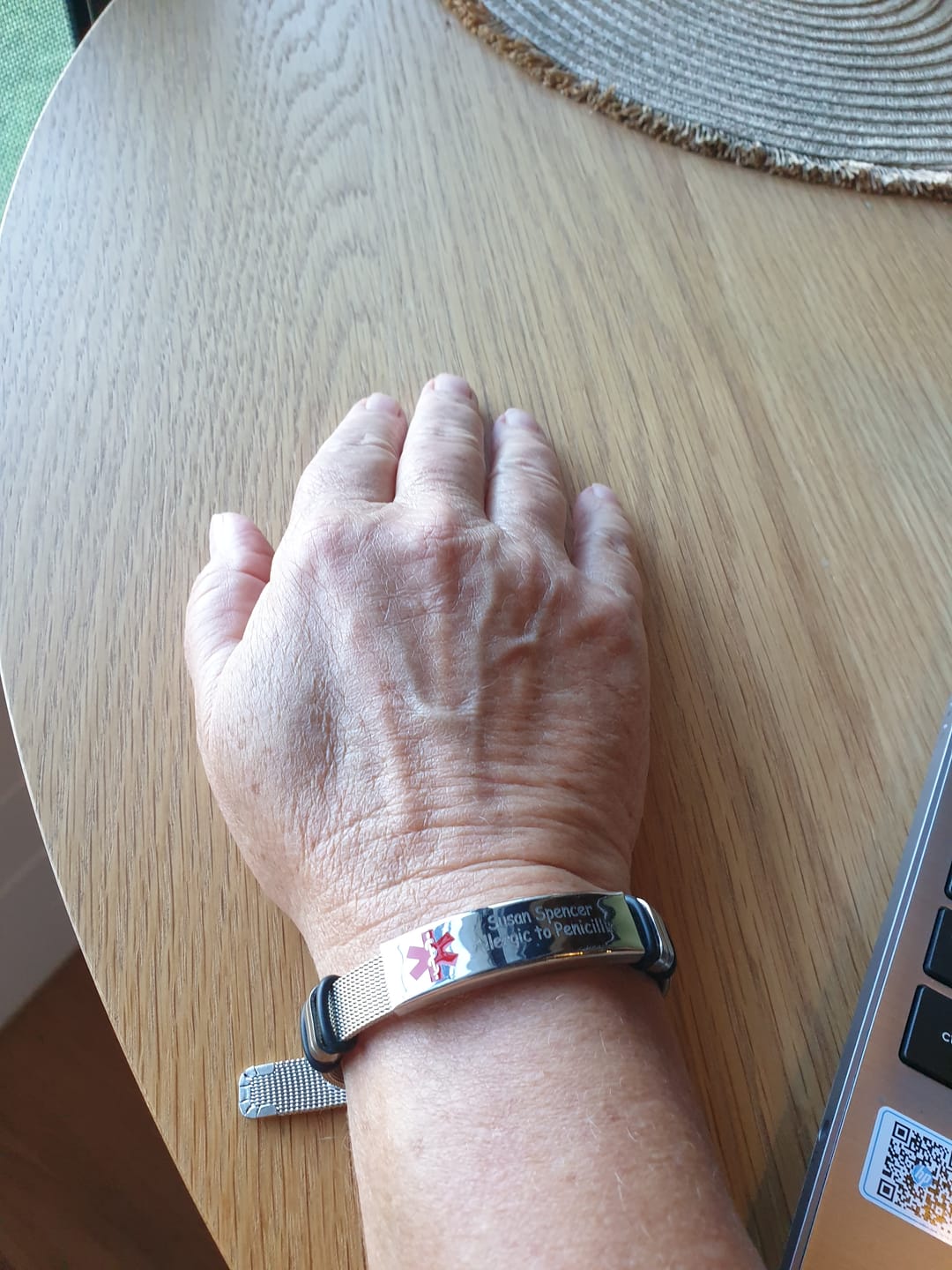 Customer photo review of Personalised Silver Steel Medical Alert ID Mesh Bracelet