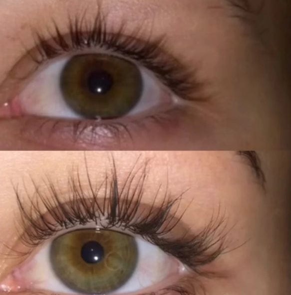 Customer photo review of Eyelash Growth Serum