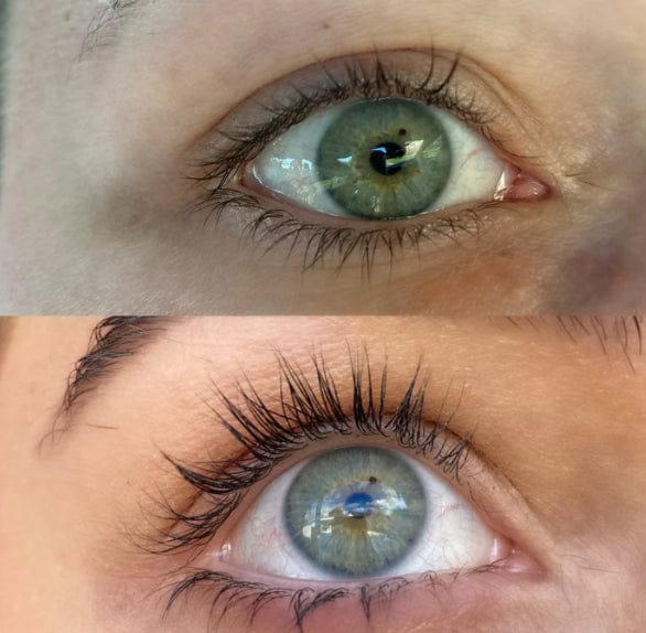 Customer photo review of Eyelash Growth Serum