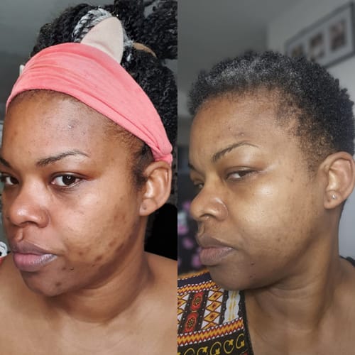 Customer photo review of Turmeric Glow Soap