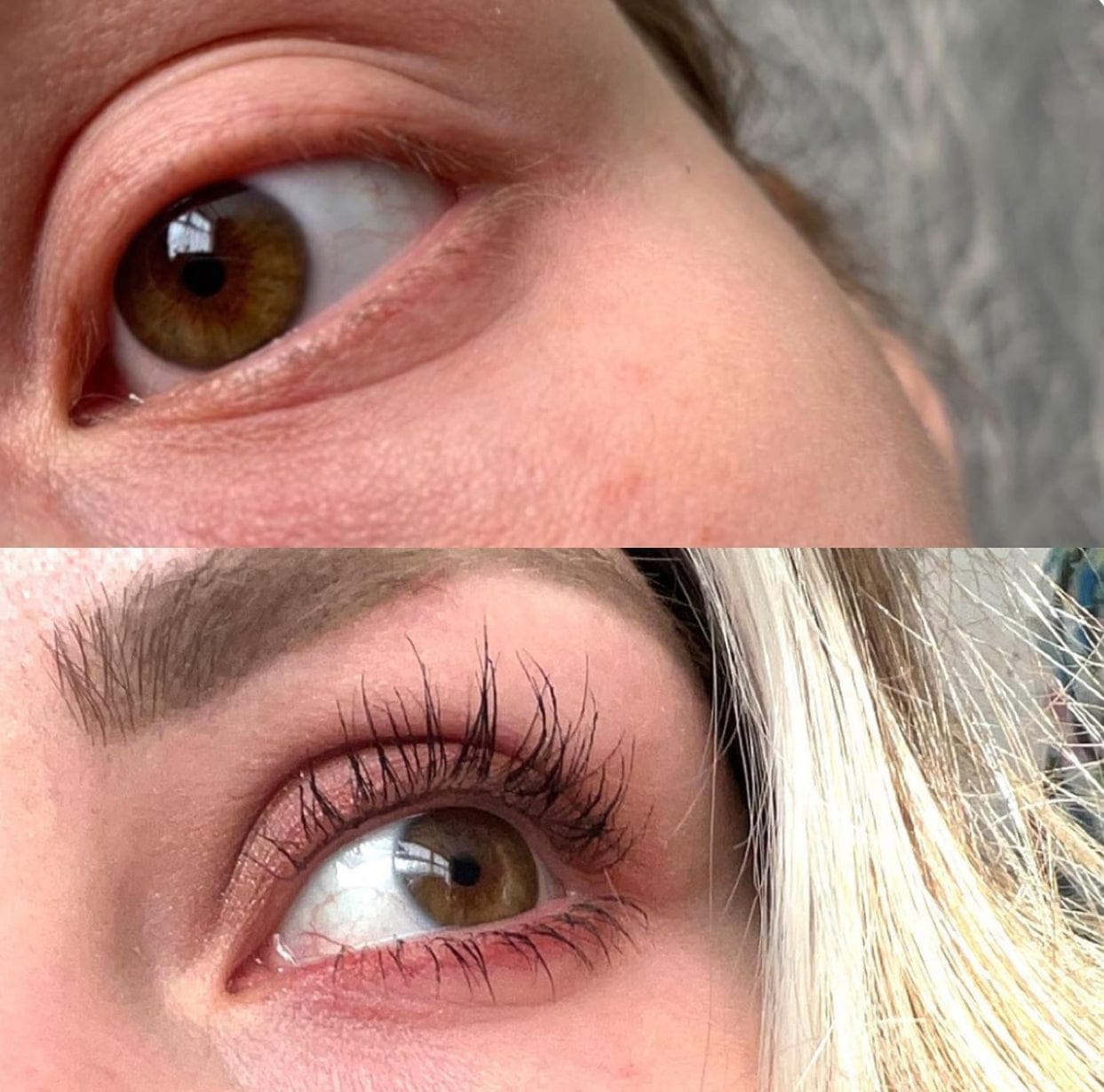 Customer photo review of Eyelash Growth Serum