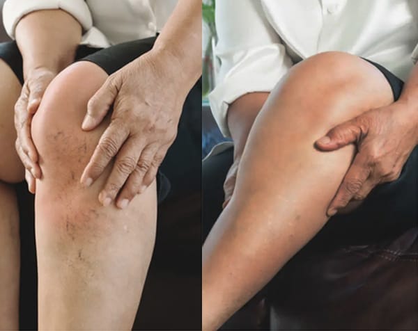 Customer photo review of Air Compression Massager – Wireless Recovery for Leg Circulation & Muscle Relief