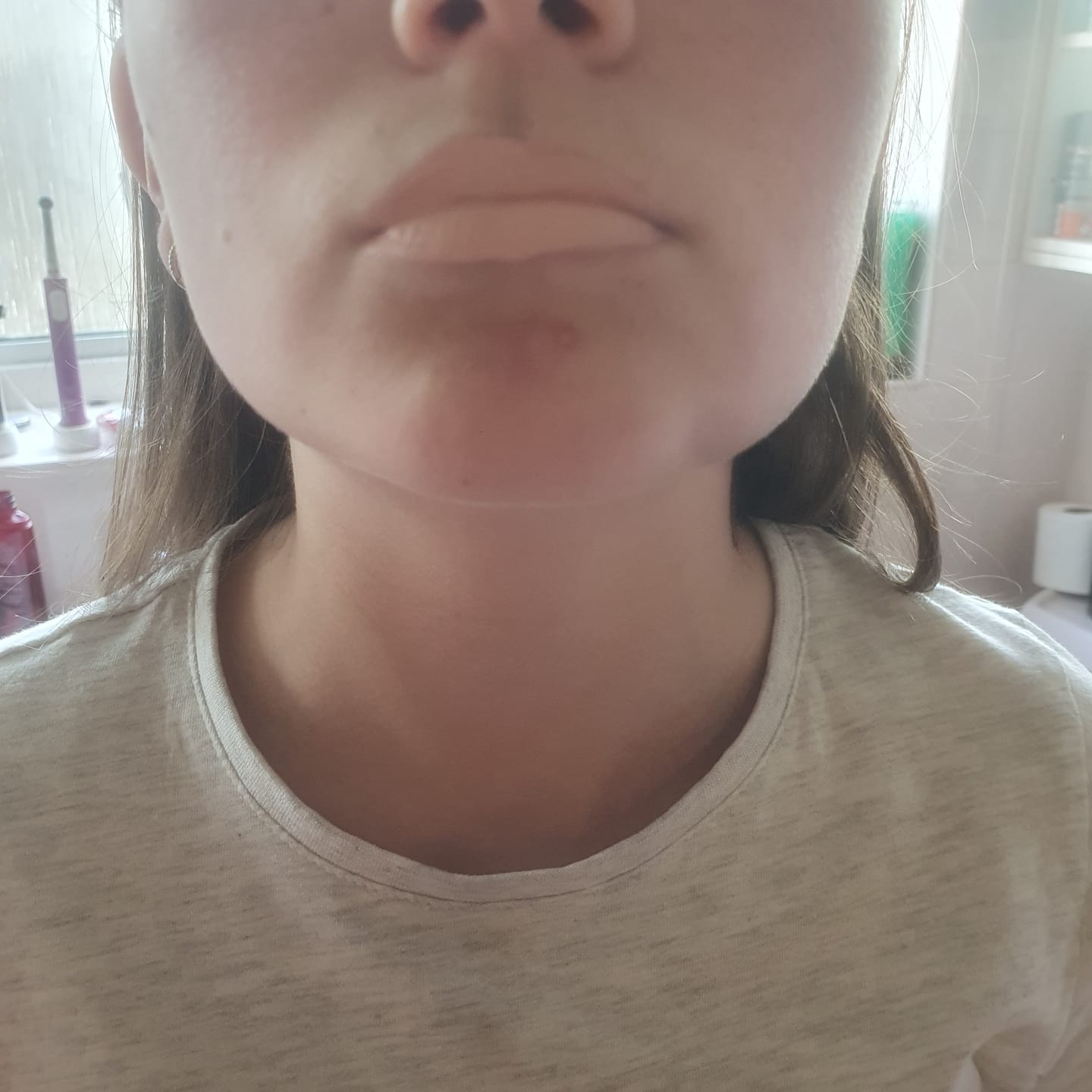 Customer photo review of P.Louise Lip Base