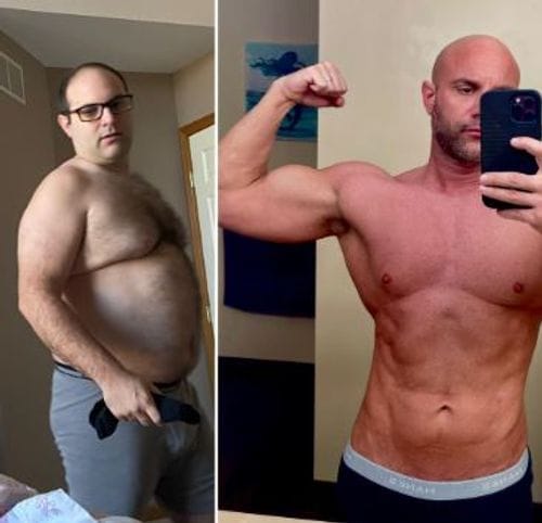 Customer photo review of 🌟2025 Breakthrough🌟 QIAWI ® PureGLP-1 Nano Microneedle Patch