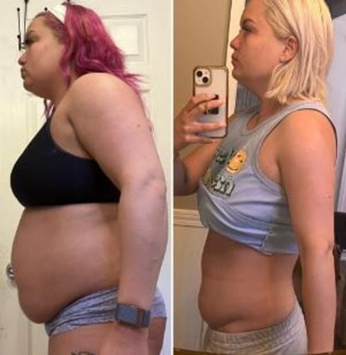 Customer photo review of 🌟2025 Breakthrough🌟 QIAWI ® PureGLP-1 Nano Microneedle Patch