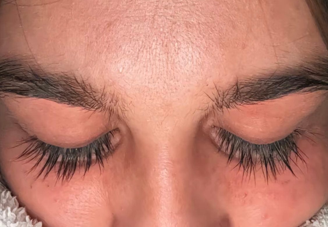 Customer photo review of Eyelash Growth Serum