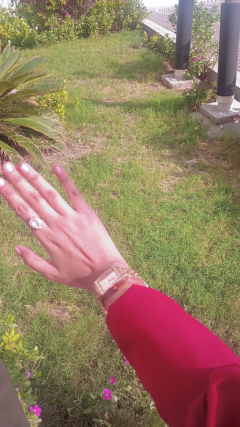 Customer photo review of Rose | 31MM