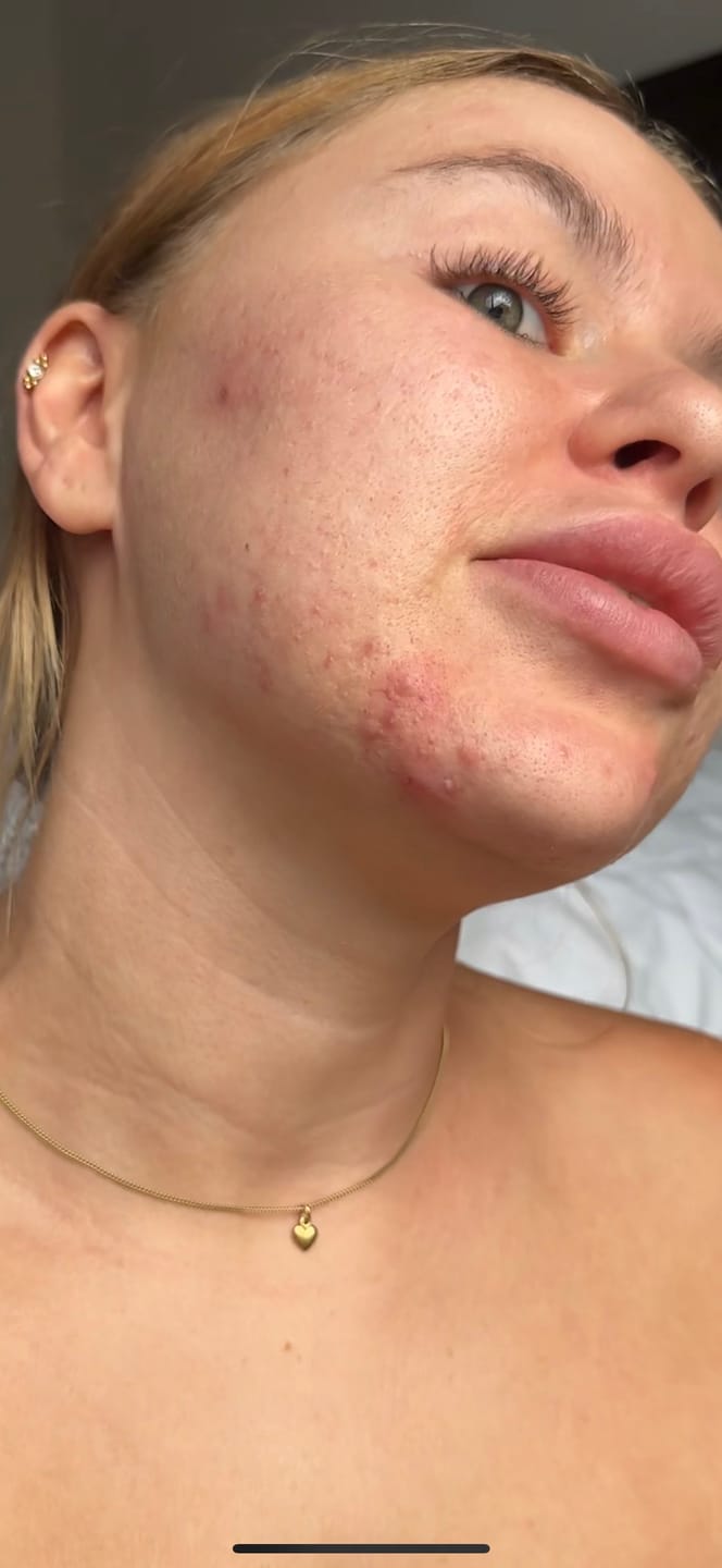 Customer photo review of ⚡ Australia’s Turmeric Clay Mask