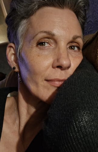 Customer photo review of F-Balm (Anti-aging Tallow Balm) 2 oz. Tin