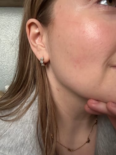 Customer photo review of Daisy Huggies