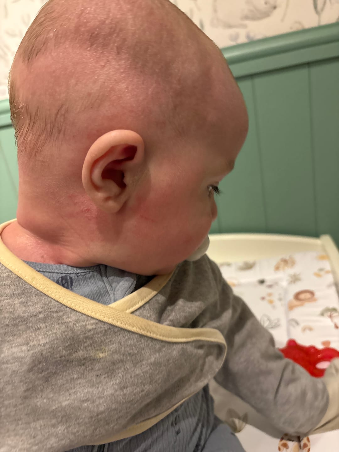 Customer photo review of Bioskin Junior Duo Pack